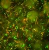 Lyme Disease Bacteria, Borrelia burgdorferi Credit: NIAID, NIH