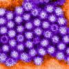 Digitally colorized transmission electron micrograph of Norovirus virions. Photo credit: Charles D. Humphrey, CDC