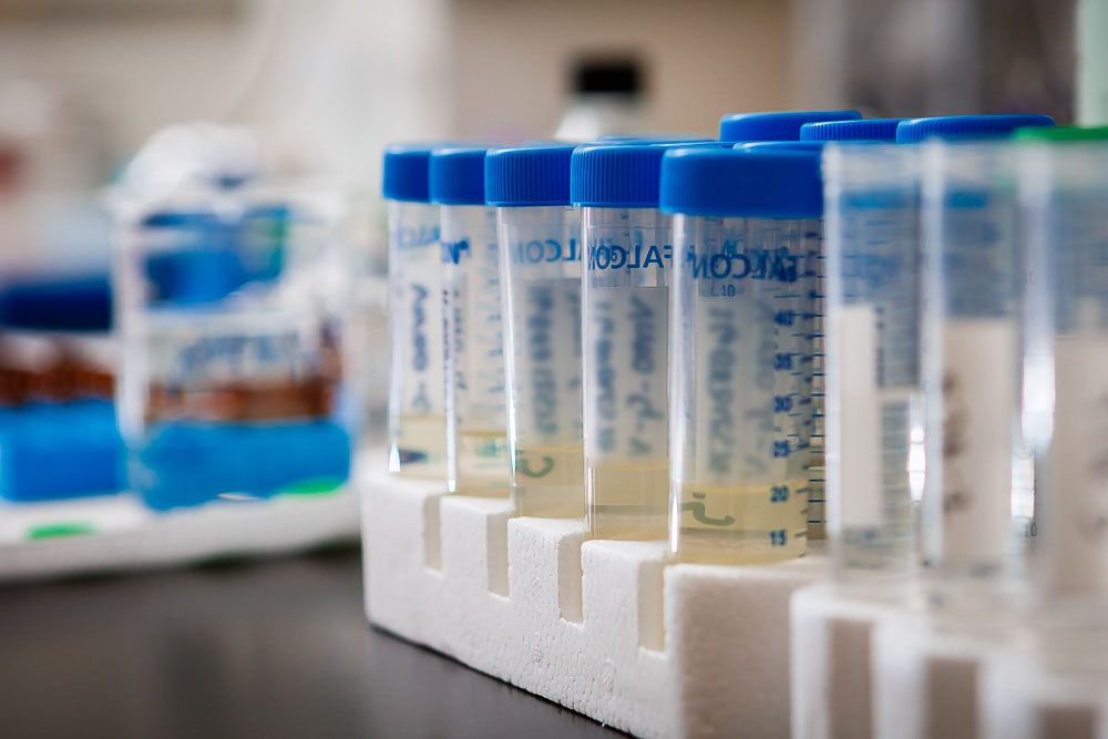 Tubes containing urine specimens