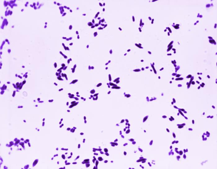 Streptococcus pneumoniae Photo credit: CDC / Arnold Kaufman