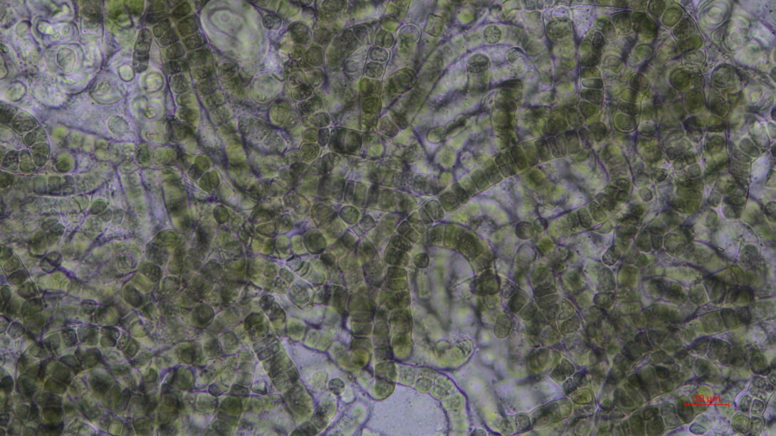Micrograph of Aetokthonos hydrillicola culture. Photo credit: Chris Tucker.
