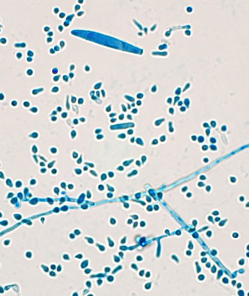 Trichophyton indotineae with macro and micro conidia 