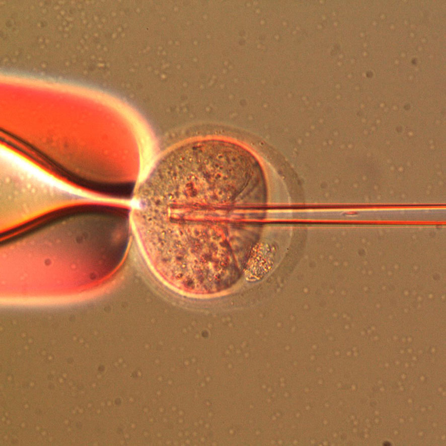 mouse ICSI (Intra-cytoplasmic sperm injection) mouse ICSI (Intra-cytoplasmic sperm injection)