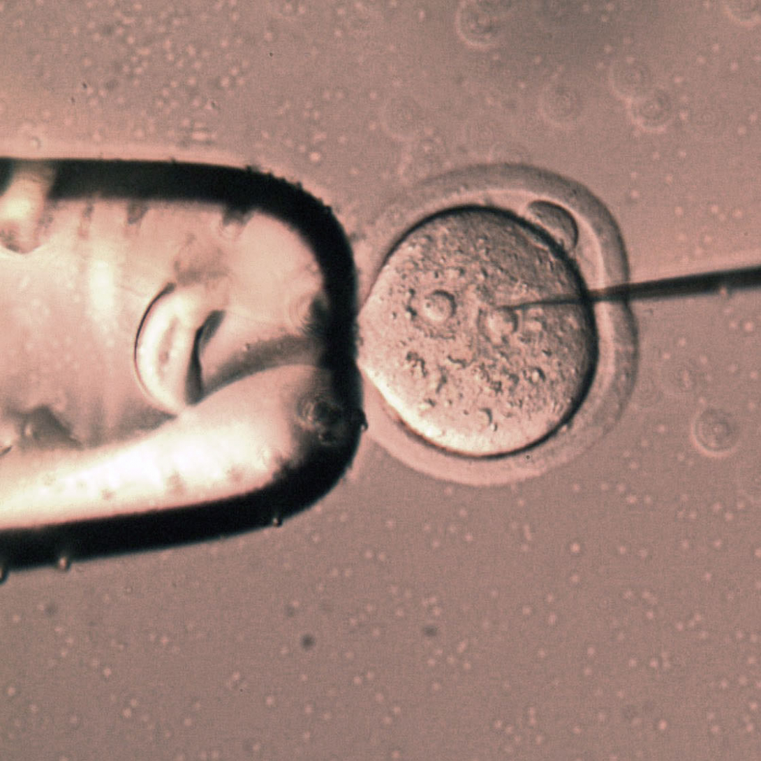 Pronuclear microinjection of fertilized mouse embryo Pronuclear microinjection of fertilized mouse embryo