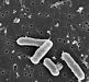 Scanning electron micrographs of Salmonella treated with a neutralizing antibodies Sal4. Control bacteria
